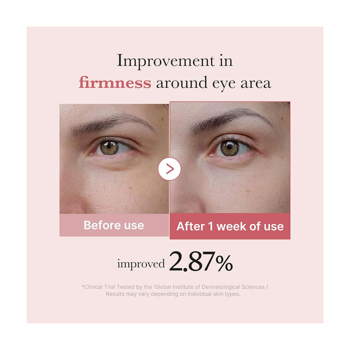 MEDICUBE PDRN Pink Peptide Eye Cream - Peaches&Creme Shop Korean Skincare Malta