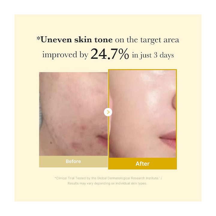 MEDICUBE Kojic Acid Turmeric Night Wrapping Mask - Peaches&Creme Shop Korean Skincare Malta