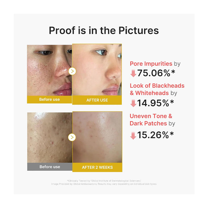 A before-and-after results graphic showing skin texture and pore improvement on a woman&