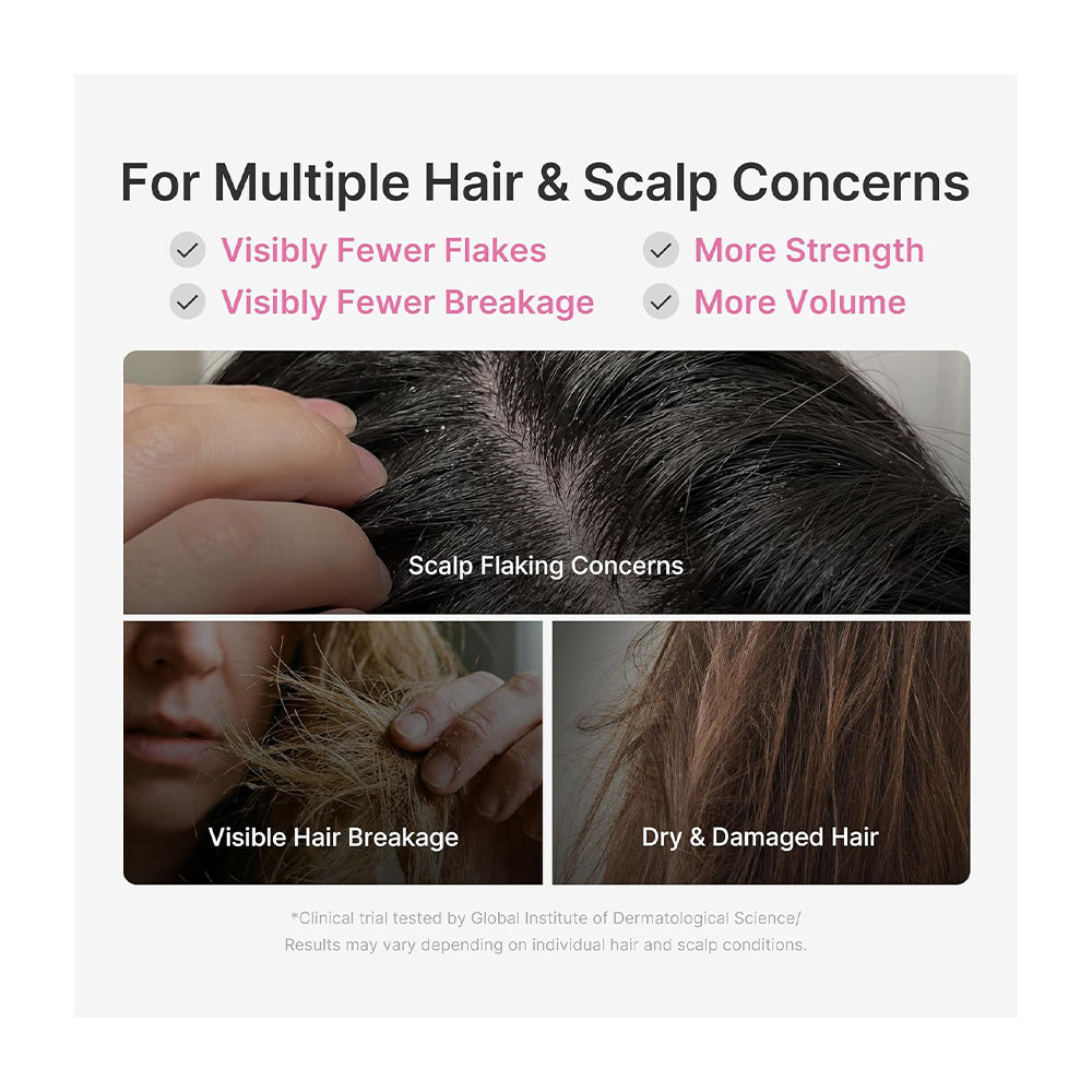An informational graphic for hair and scalp concerns, with text listing benefits such as visibly fewer flakes, more strength, more volume, and visible hair breakage reduction. Below, three close-up panels show a hand inspecting a scalp with flakes, dry hair strands, and healthier-looking brown hair.