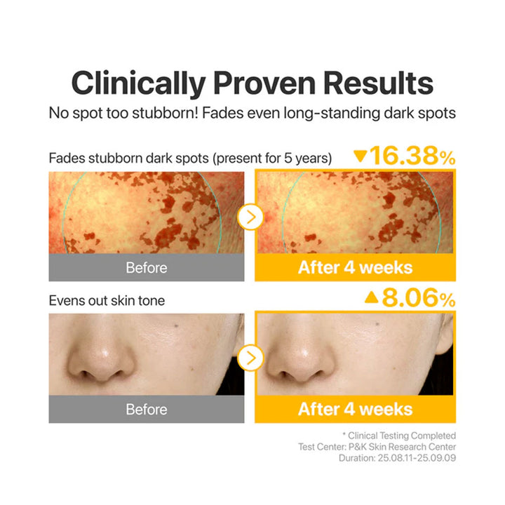 NUMBUZIN No.5 Glutathione TXA Advanced Dark Spot Ampoule Concentrate - Peaches&Creme Shop Korean Skincare Malta