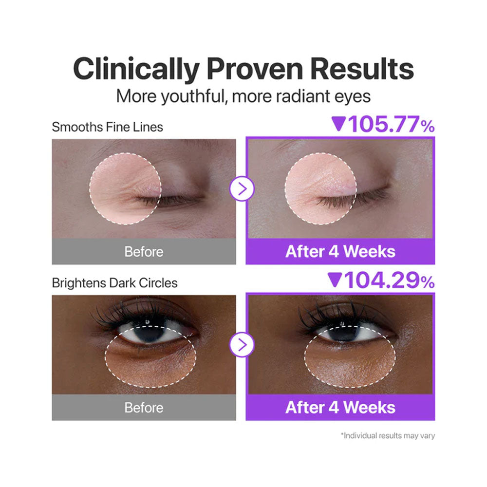 NUMBUZIN No.9 NAD+ Retinol Volumetox Eye Cream - Peaches&amp;Creme Shop Korean Skincare Malta