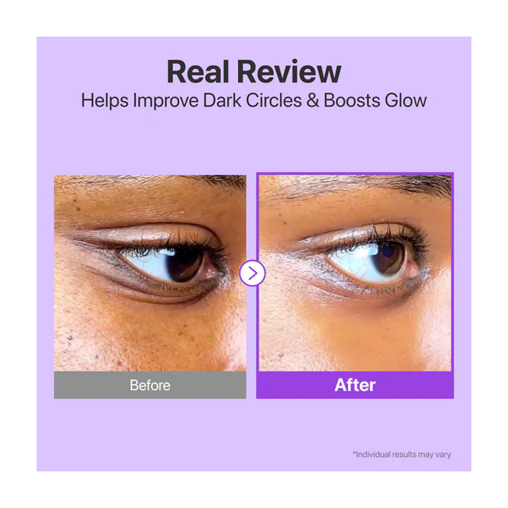 NUMBUZIN No.9 NAD+ Retinol Volumetox Eye Cream - Peaches&amp;Creme Shop Korean Skincare Malta