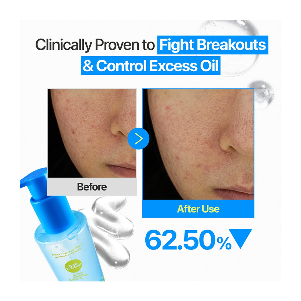 Promotional graphic for a skincare product showing before-and-after close-ups of a person&