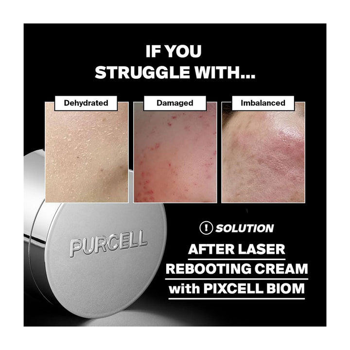 PURCELL Pixcell Biom™ After Rebooting Cream - Peaches&Creme Shop Korean Skincare Malta