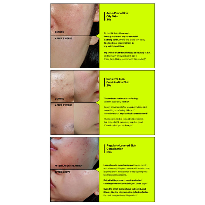 PURCELL Pixcell Biom™ 2 Billion/mL - Peaches&Creme Shop Korean Skincare Malta