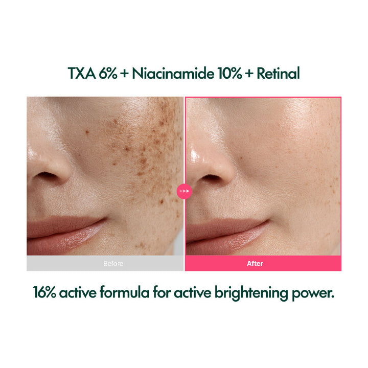 PURITO SEOUL TXA 6 Niacinamide 10 Retinal Serum - Peaches&Creme Shop Korean Skincare
