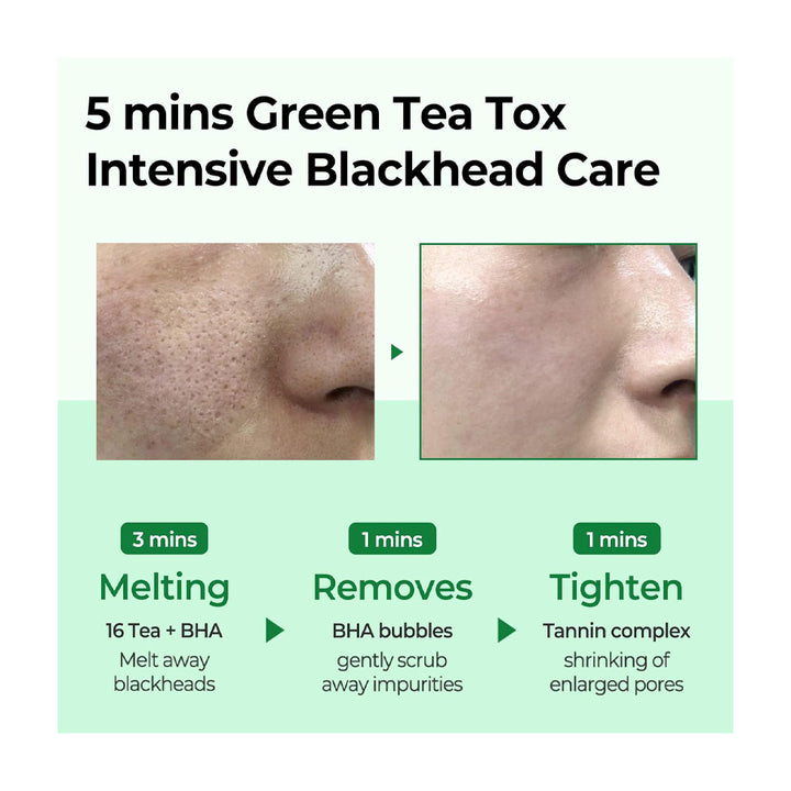 SOME BY MI Bye Bye Blackhead 30 Days Miracle Green Tea Tox Bubble Cleanser - Peaches&Creme Shop Korean Skincare Malta