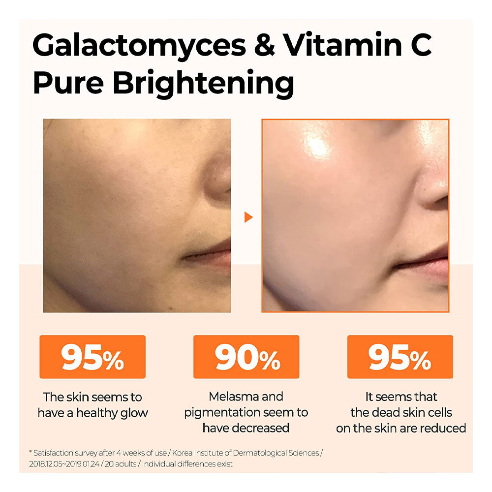 Galactomyces Pure Vitamin C Glow Serum