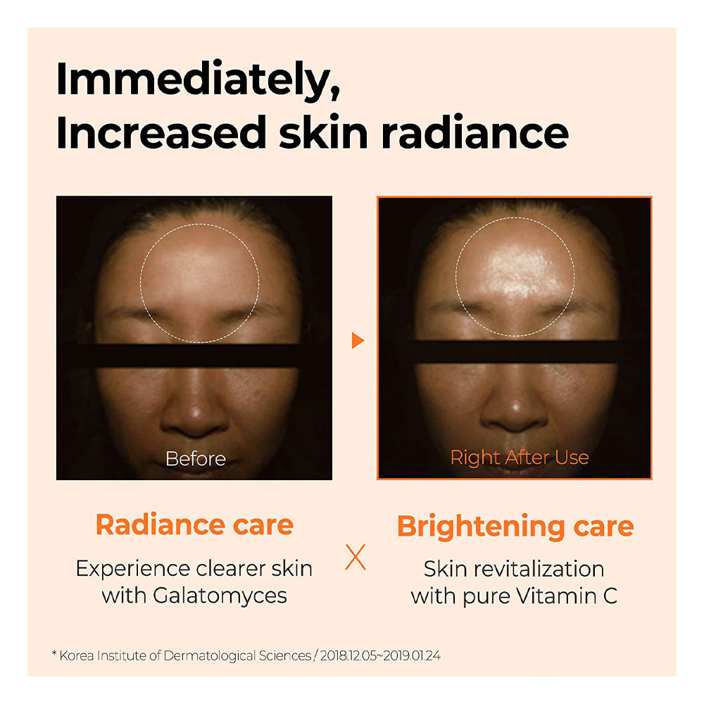 Galactomyces Pure Vitamin C Glow Serum
