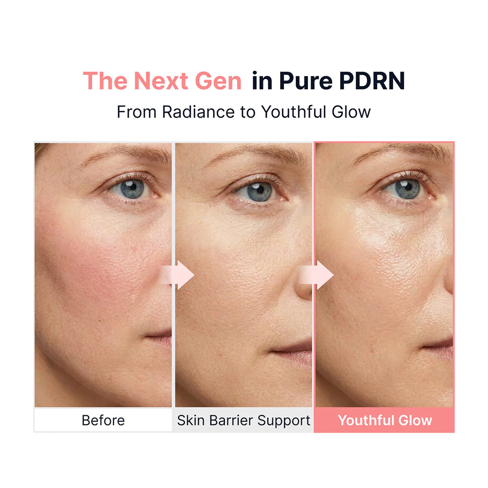 Before and after comparison of skin with Pure PDRN, showing radiance to youthful glow.