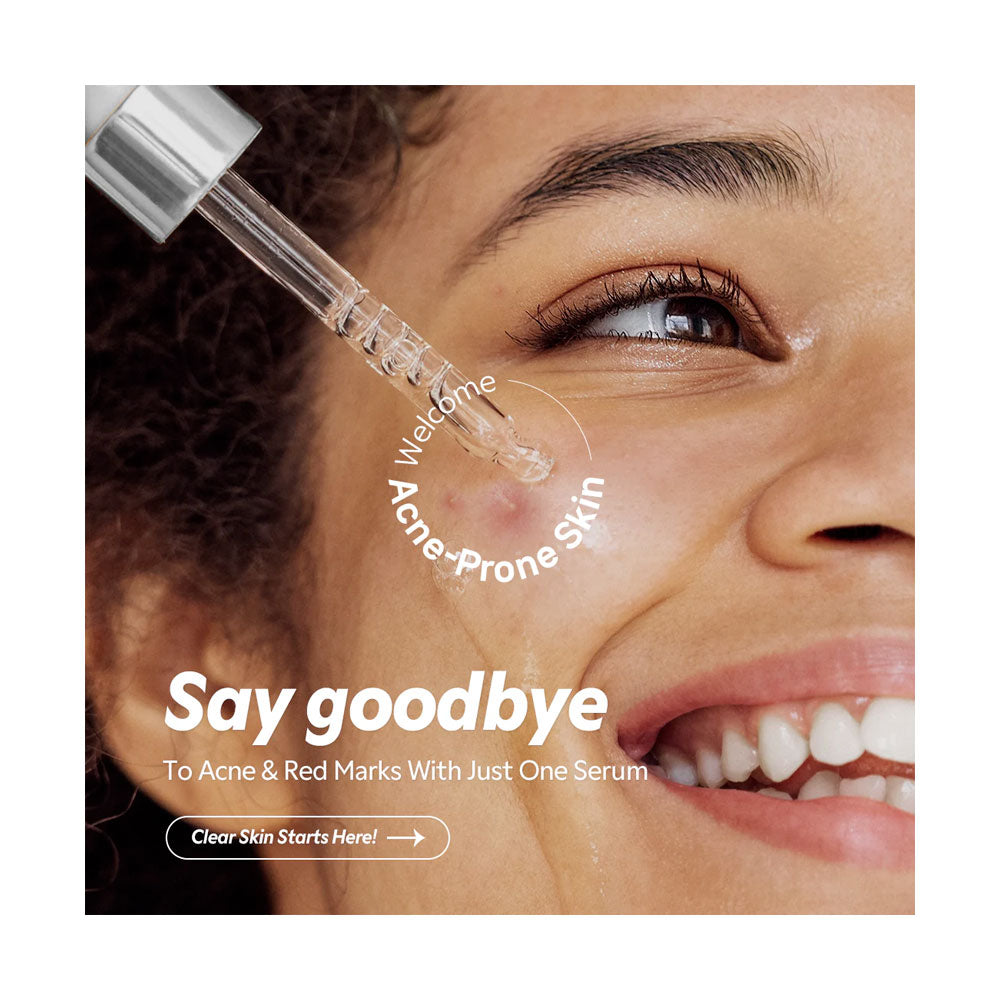 TIRTIR Azelaic Acid 12% Serum - Peaches&Creme Shop Korean Skincare Malta