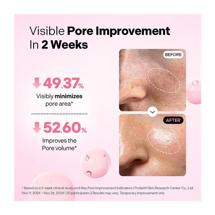 A pink promotional graphic for a skincare product showing before-and-after close-ups of a person&