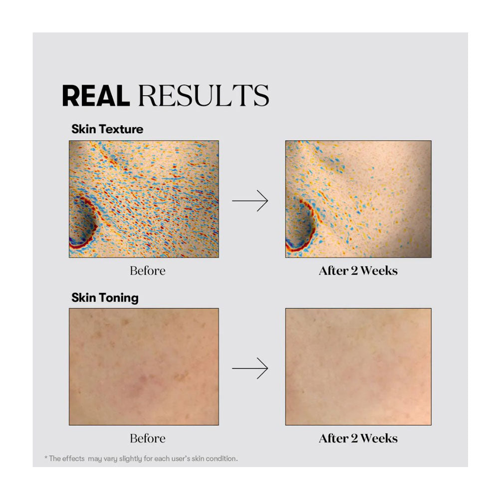 VT COSMETICS TX-Toning Toner - Peaches&Creme Shop Korean Skincare Malta