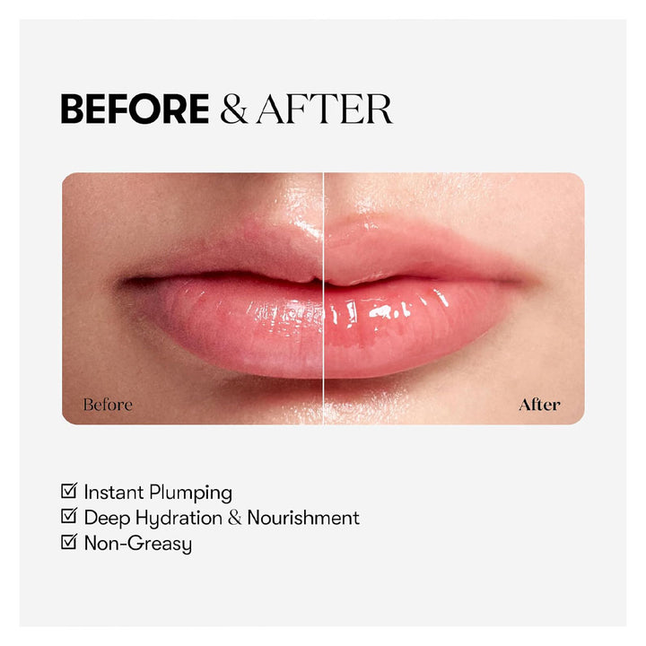 VT Reedle Shot Lip Plumper - Peaches&Creme Shop Korean Skincare Malta