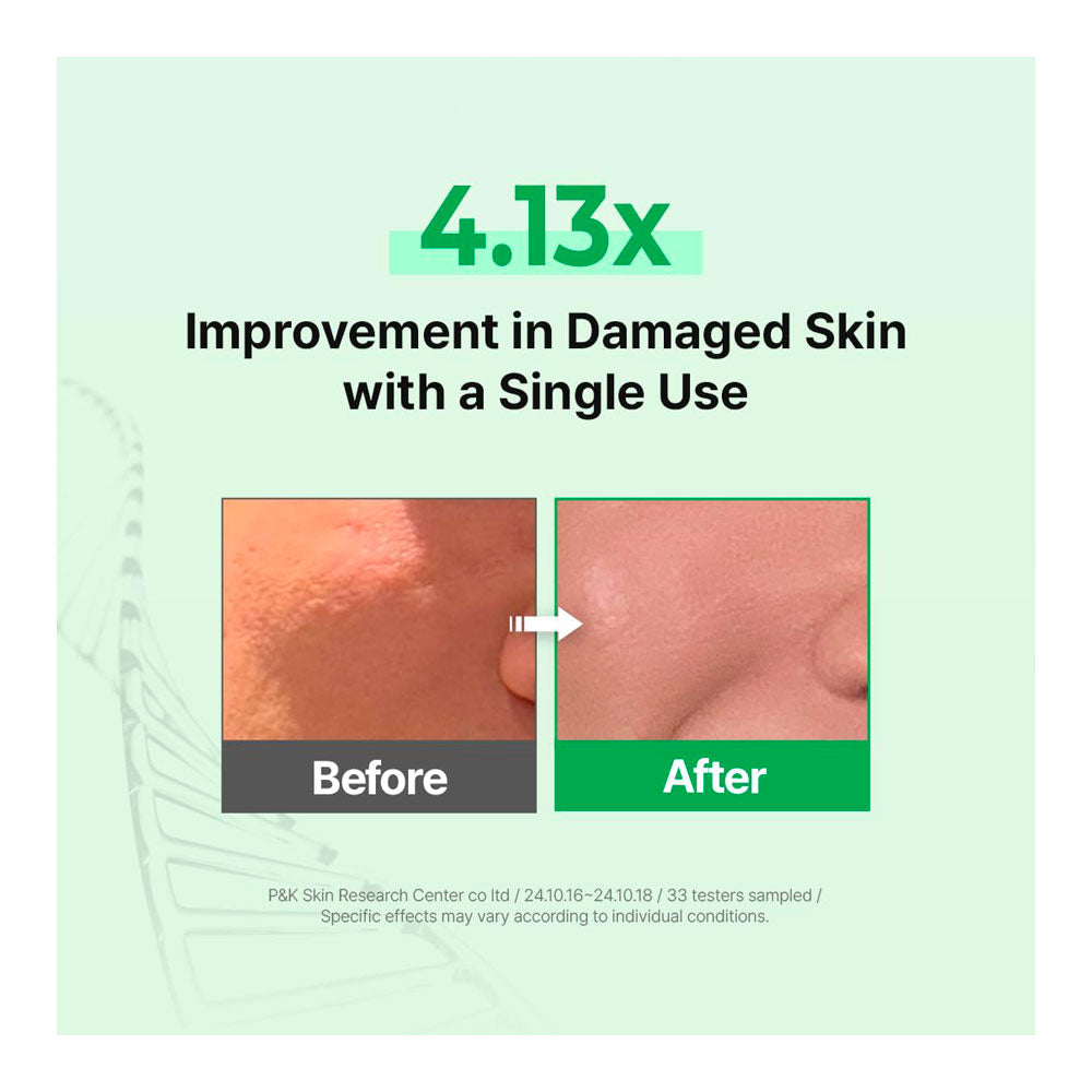 Promotional graphic showing a before-and-after comparison of damaged skin, with text reading &