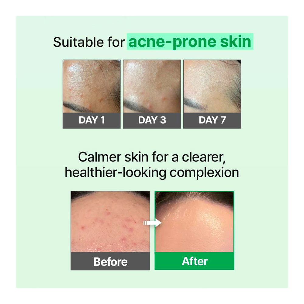 A light green informational graphic for a skincare product. The top text reads &