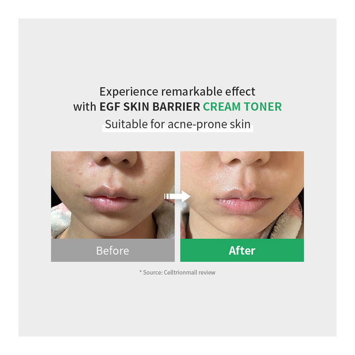 Before-and-after comparison of a person&