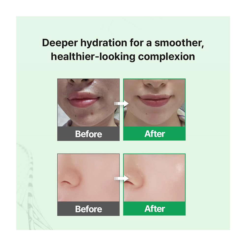 Before-and-after skincare comparison graphic showing close-up views of a person&