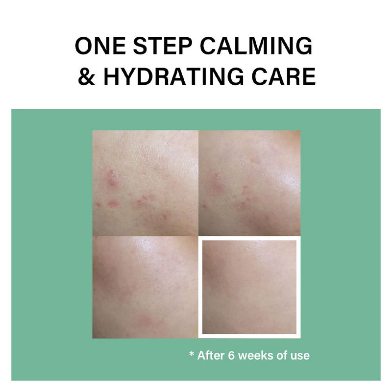Celimax The Real Cica Calming Ampoule - Peaches&Creme Shop Korean Skincare Malta