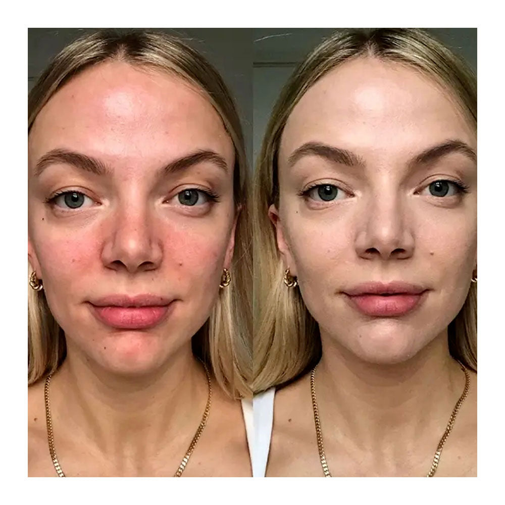 Dr. Jart+ Cicapair Tiger Grass Color Correcting Treatment - Peaches&Creme Shop Korean Skincare Malta