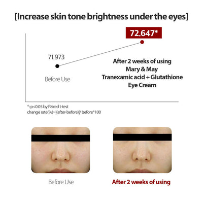 MARY & MAY Tranexamic Acid + Glutathione Eye Cream - Peaches&Creme Shop Korean Skincare Malta