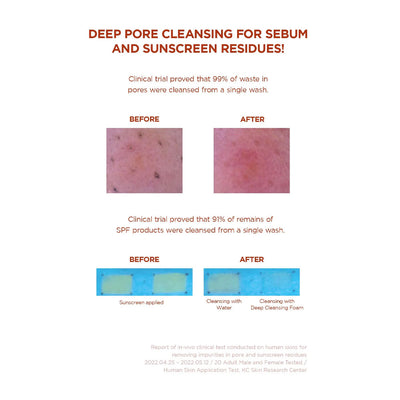 SKIN1004 Madagascar Centella Poremizing Deep Cleansing Foam - Peaches&Creme Shop Korean Skincare Malta